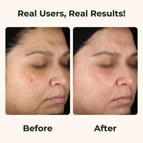 Varita LumiRevive™